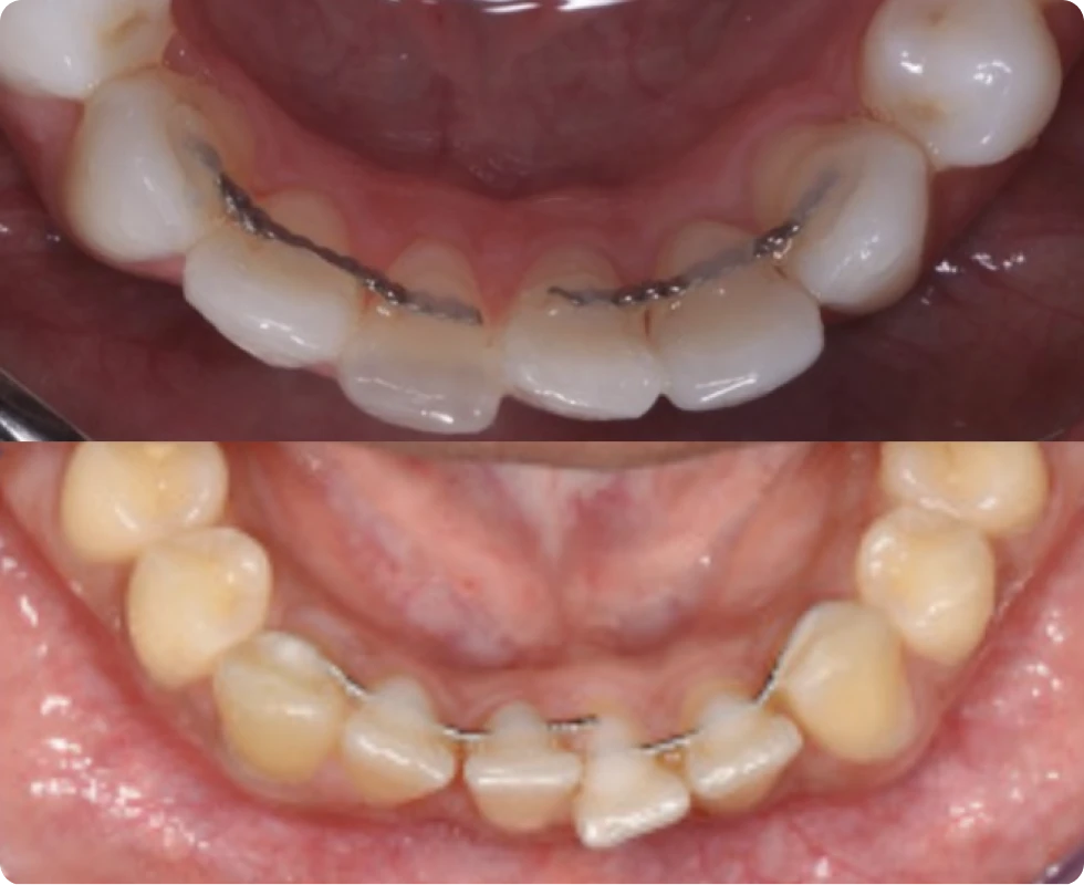 L'impact d'eZtain pour votre cabinet - plus de rendez-vous, moins de SAV