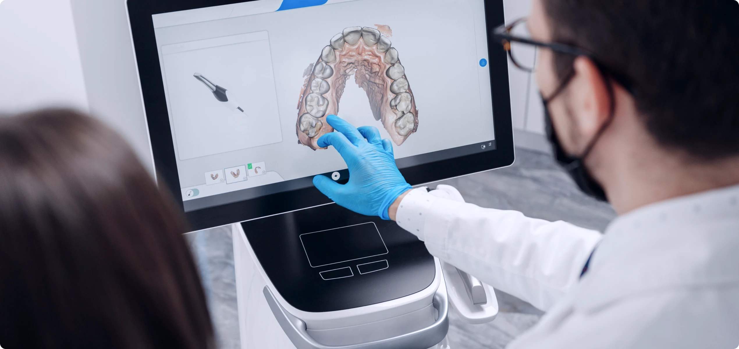 Achat sur internet de contentions orthodontiques sur mesure