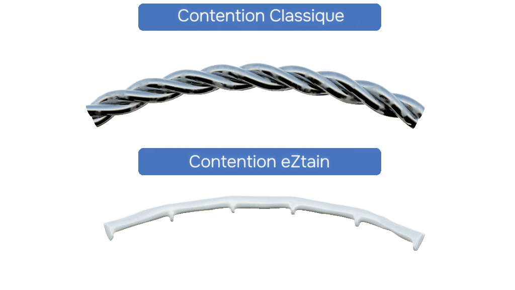 Animation fil de contention